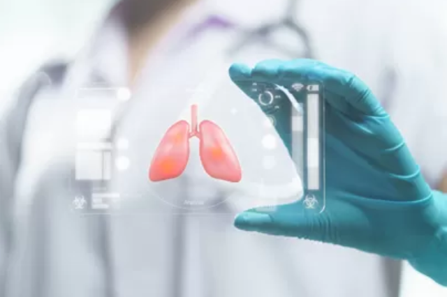pulmonary medicine doctor